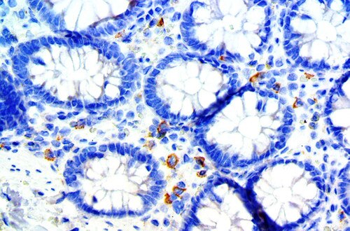 IHC of CD33 on a FFPE Colon Tissue